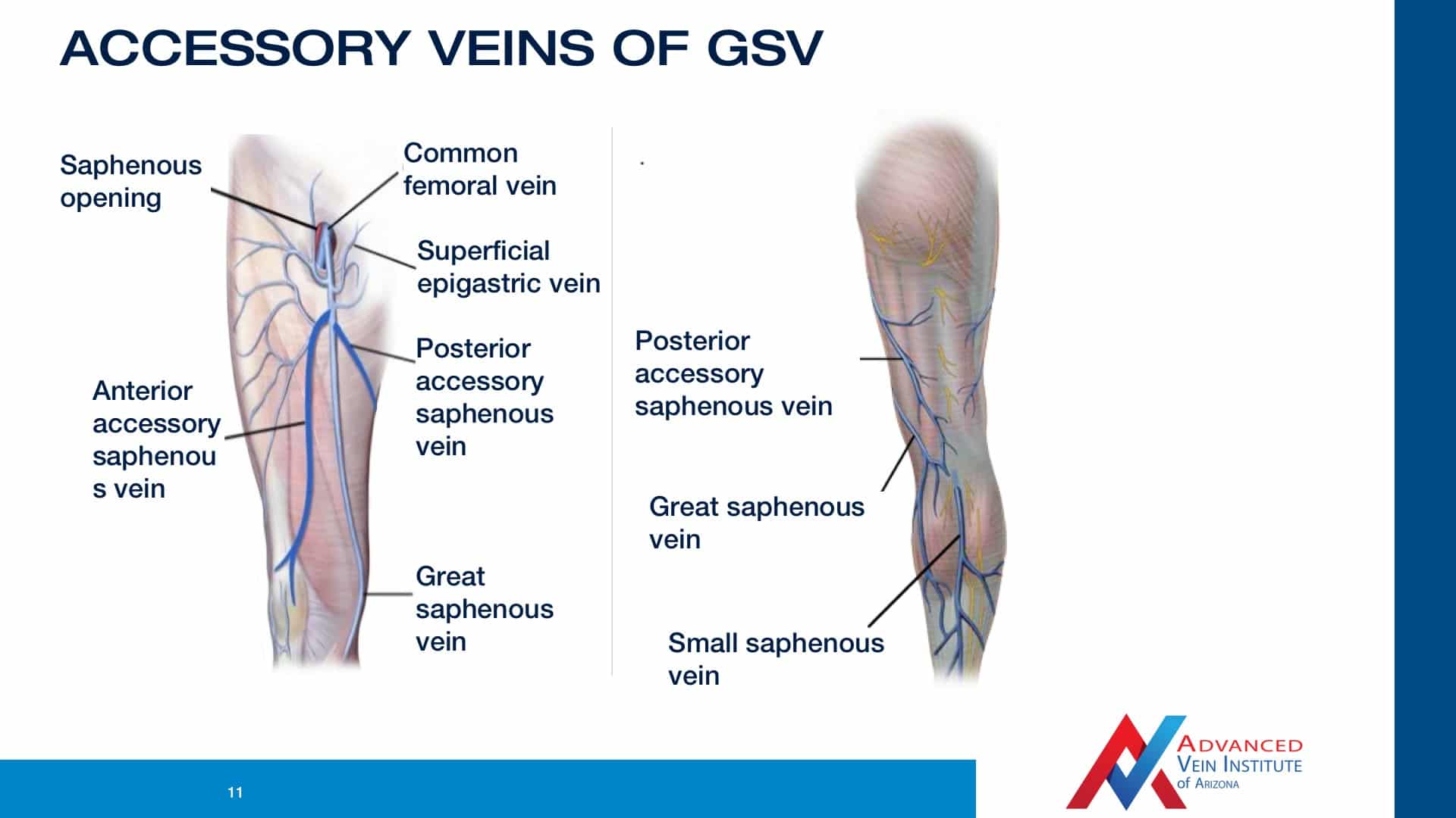 video the venous anatomy varicose vein treatment in tempe small saphenous vein
